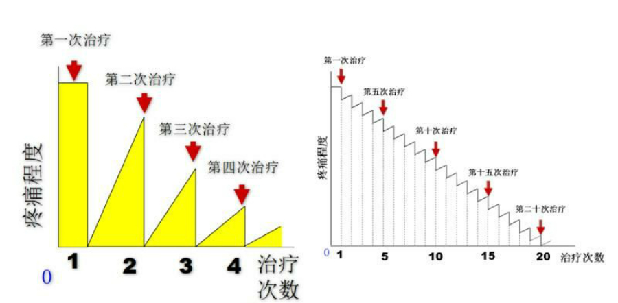 中医师承-谭兴举浮针.jpg